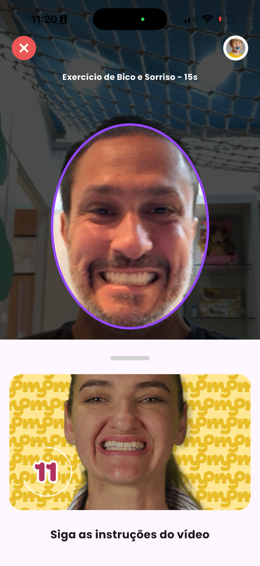 Exercício miofuncional guiado por vídeo no app Myoplay